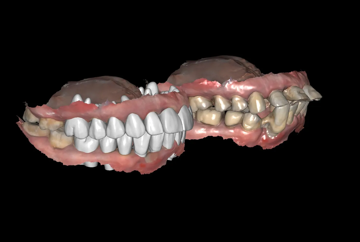 Laboratorio dental digital de FF Dental Group: diseño CAD/CAM de prótesis